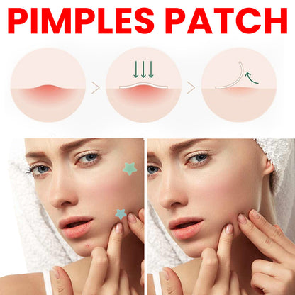 K-Beauty Blemish Patch